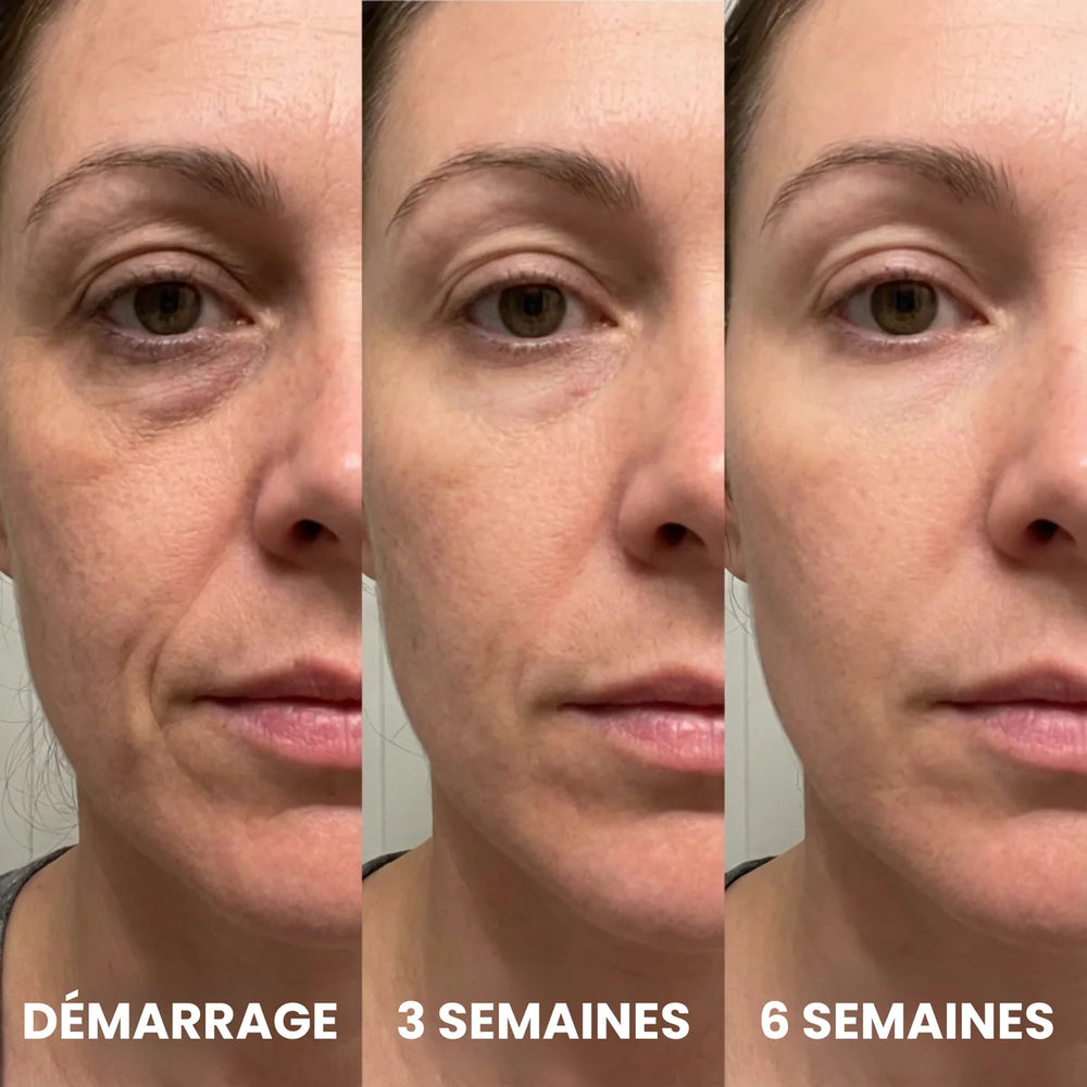 Application du stick GOYO sur le contour de la bouche