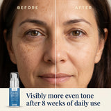 Dark Spot Corrector image 3