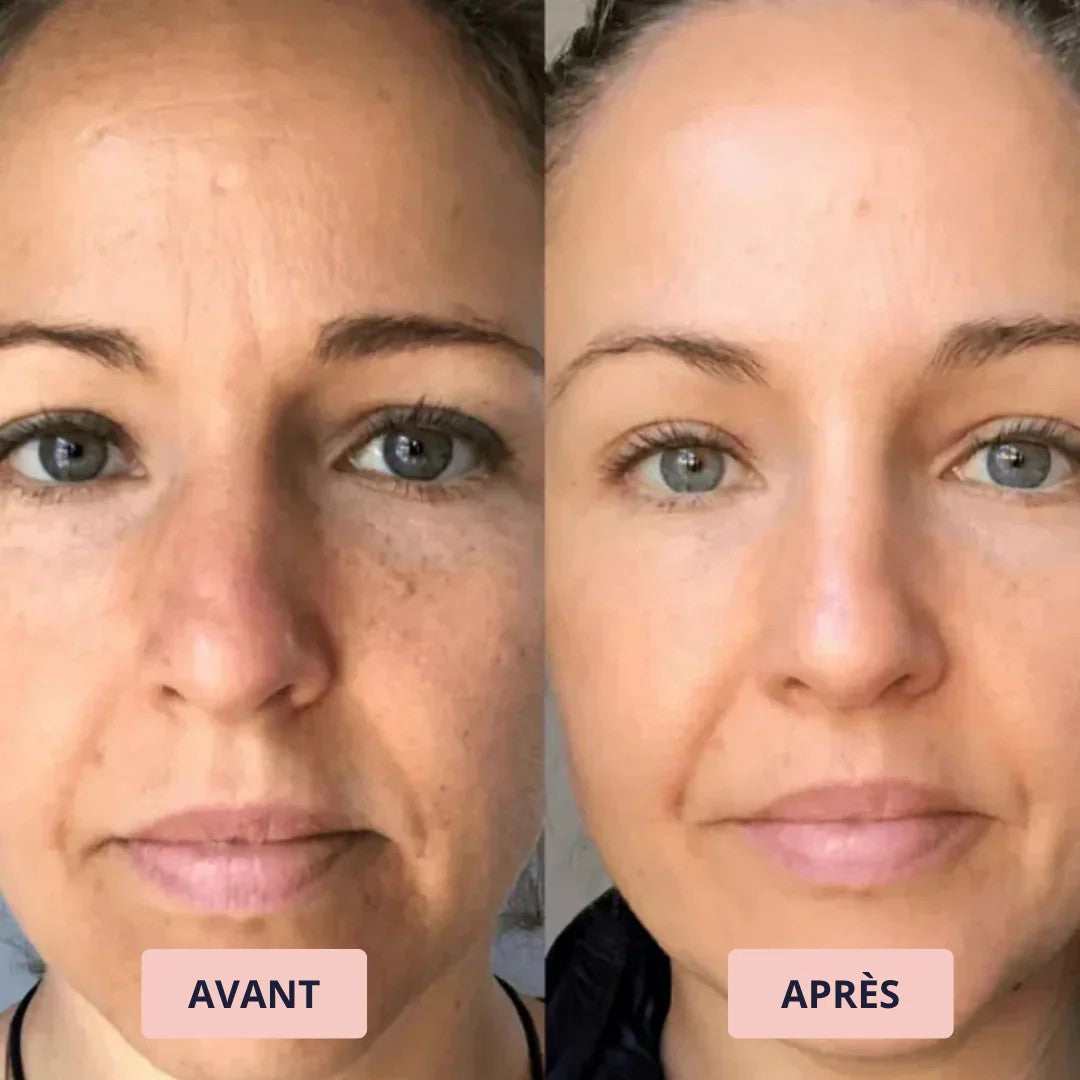 Avant et après : Evelyne S.