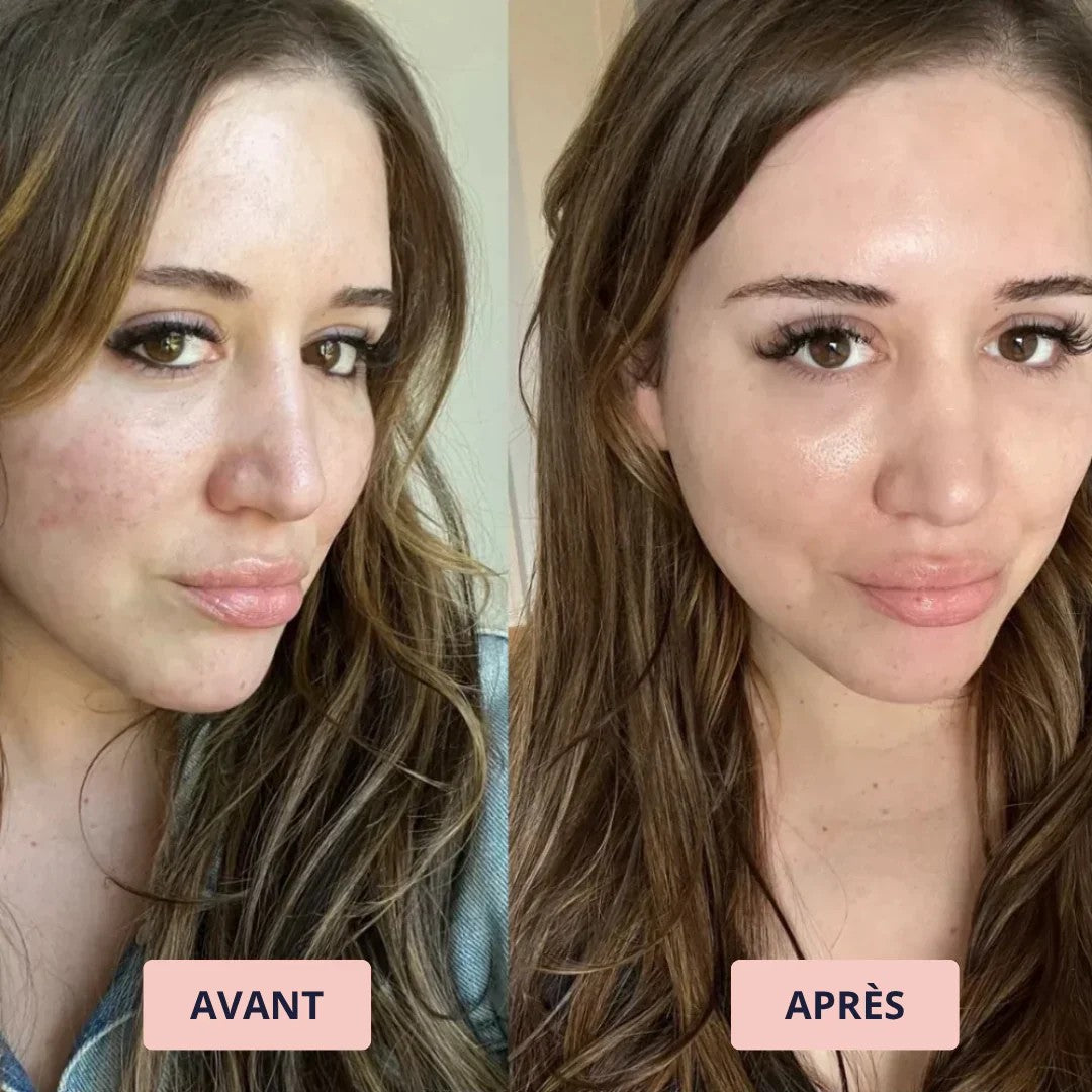 Avant et après : Laura I.