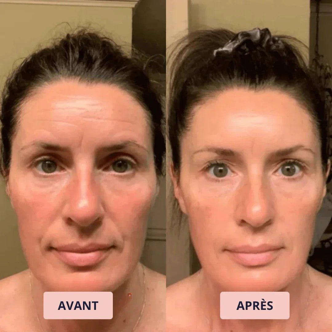 Avant et après : Stéphanie A.
