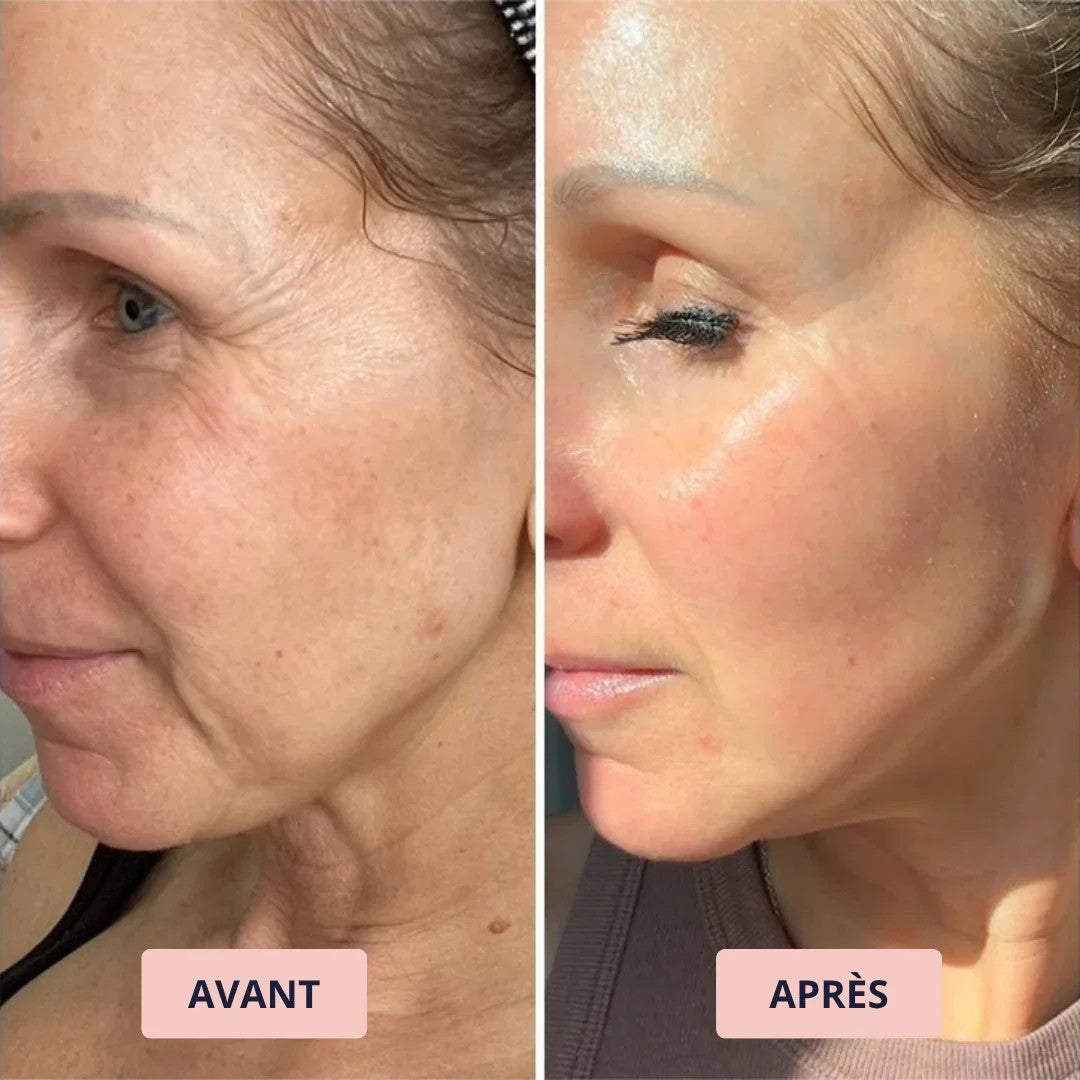 Avant et après : Sylvie D.