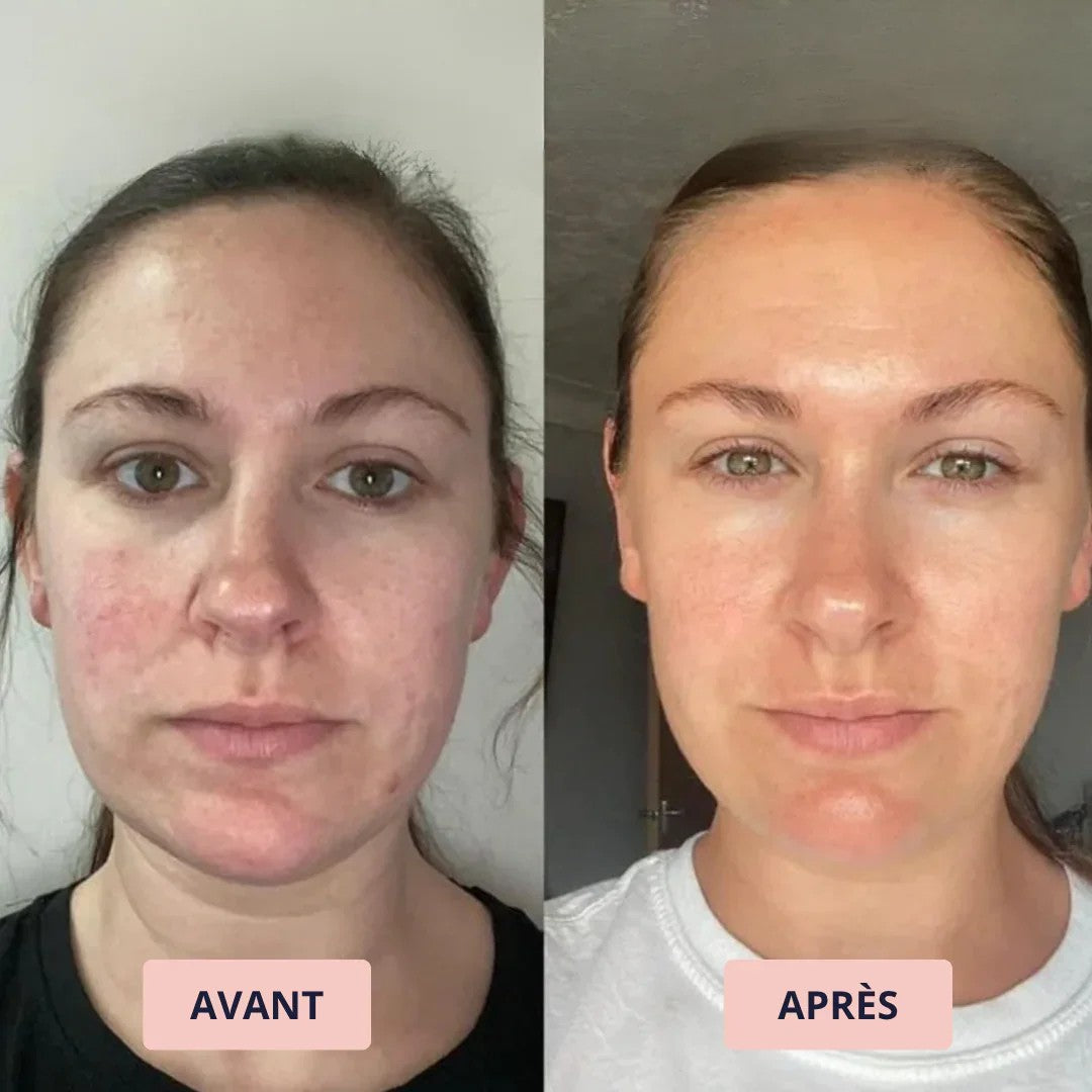 Avant et après : Violette T.